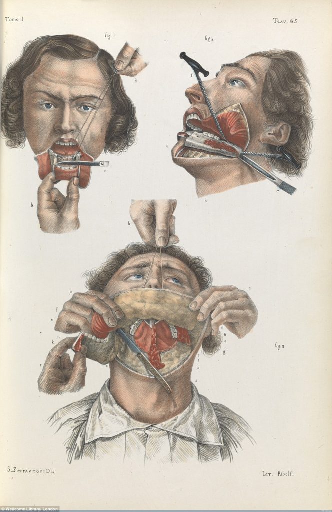 19 century jaw