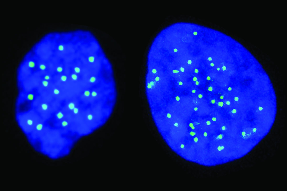 على اليسار خلية بها 23 كروموسوم، وعلى اليمين خلية بها 46 كروموسوم – المصدر: المعهد الطبي بجامعة كولومبيا/ الجامعة العبرية