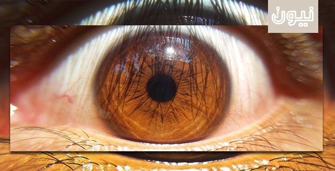 زراعة الخلايا الجذعية من شخص في عين آخر